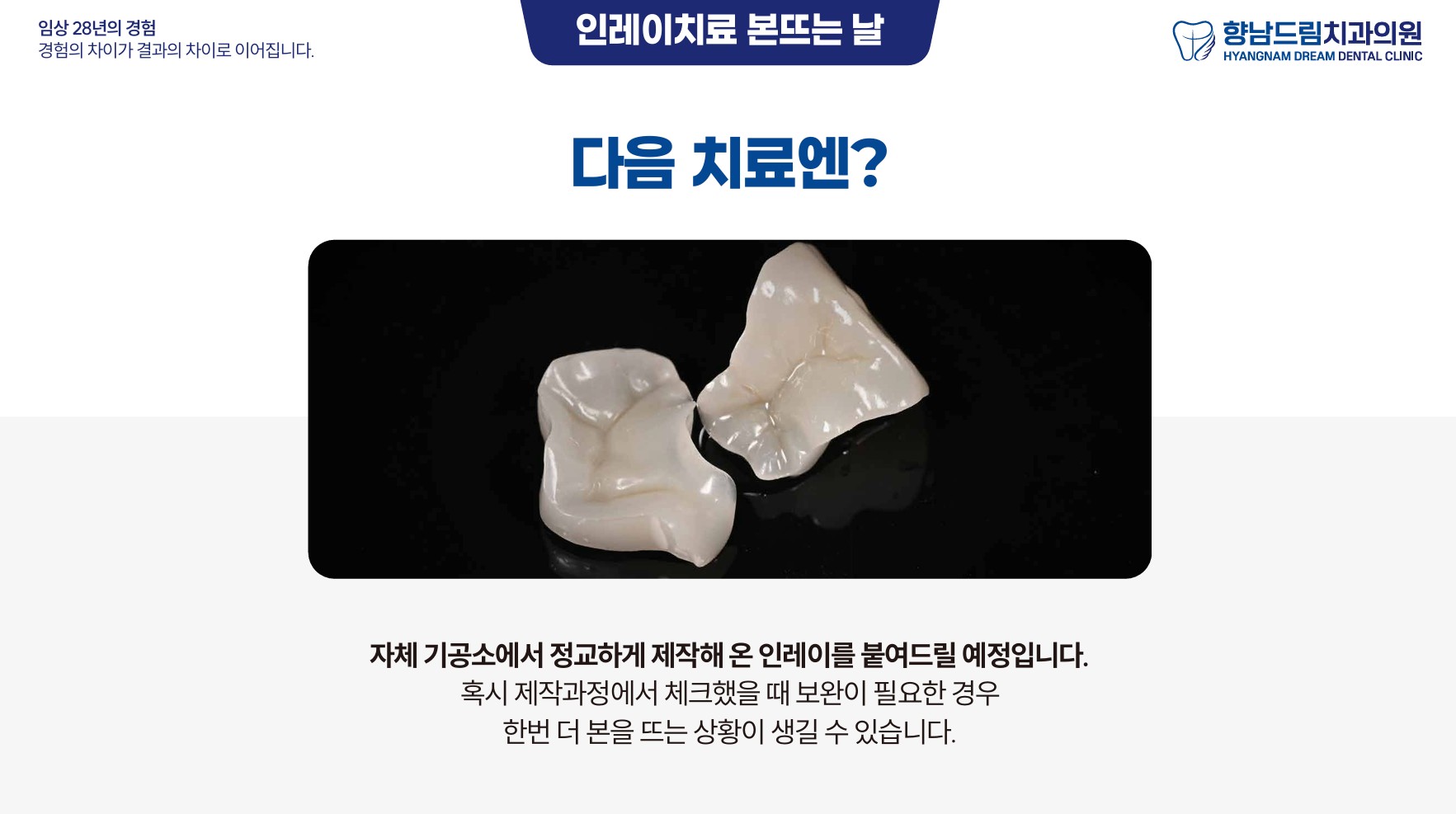 인레이 본뜨는 날 과정 5