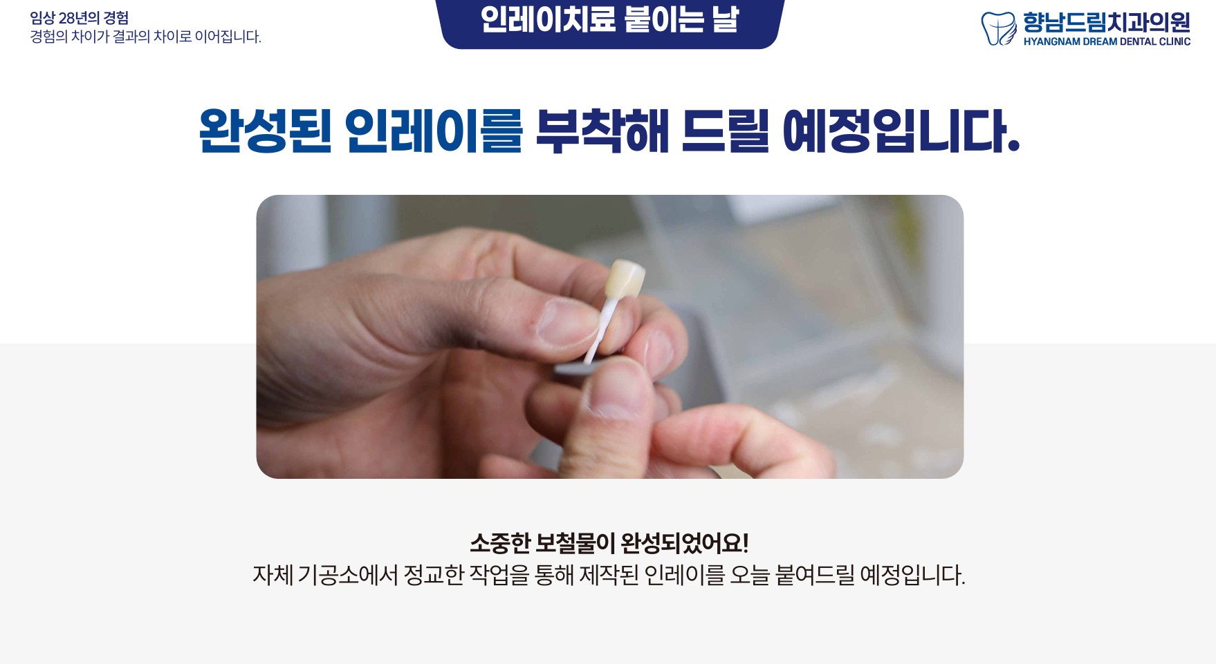 인레이 붙이는 날 과정 1