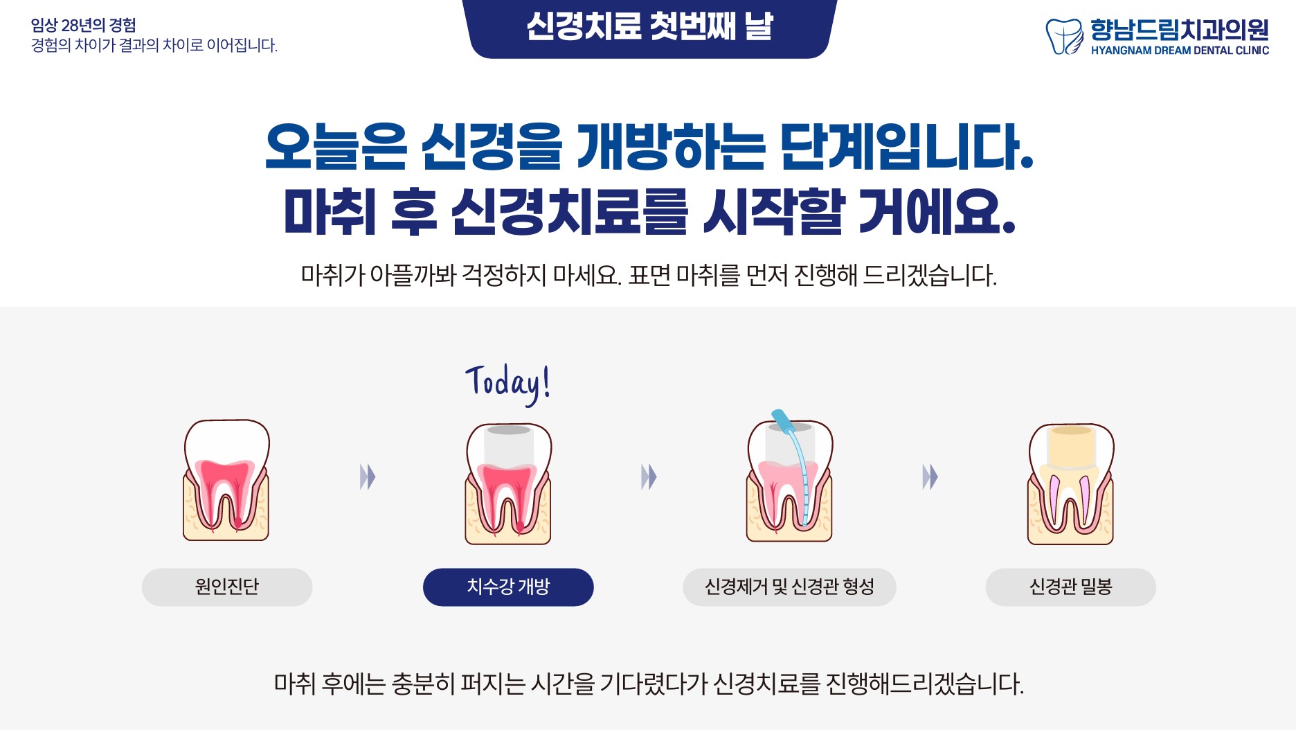 신경치료 첫째날 과정 3