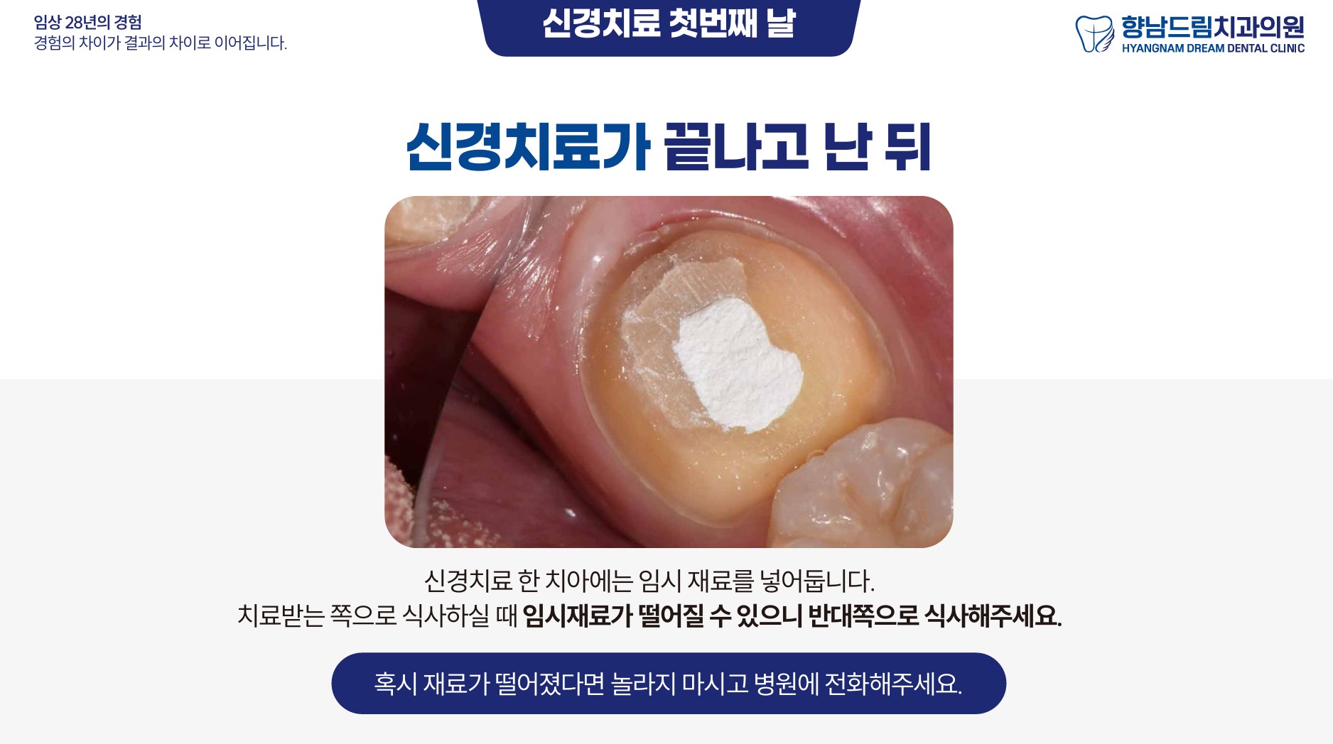 신경치료 첫째날 과정 5