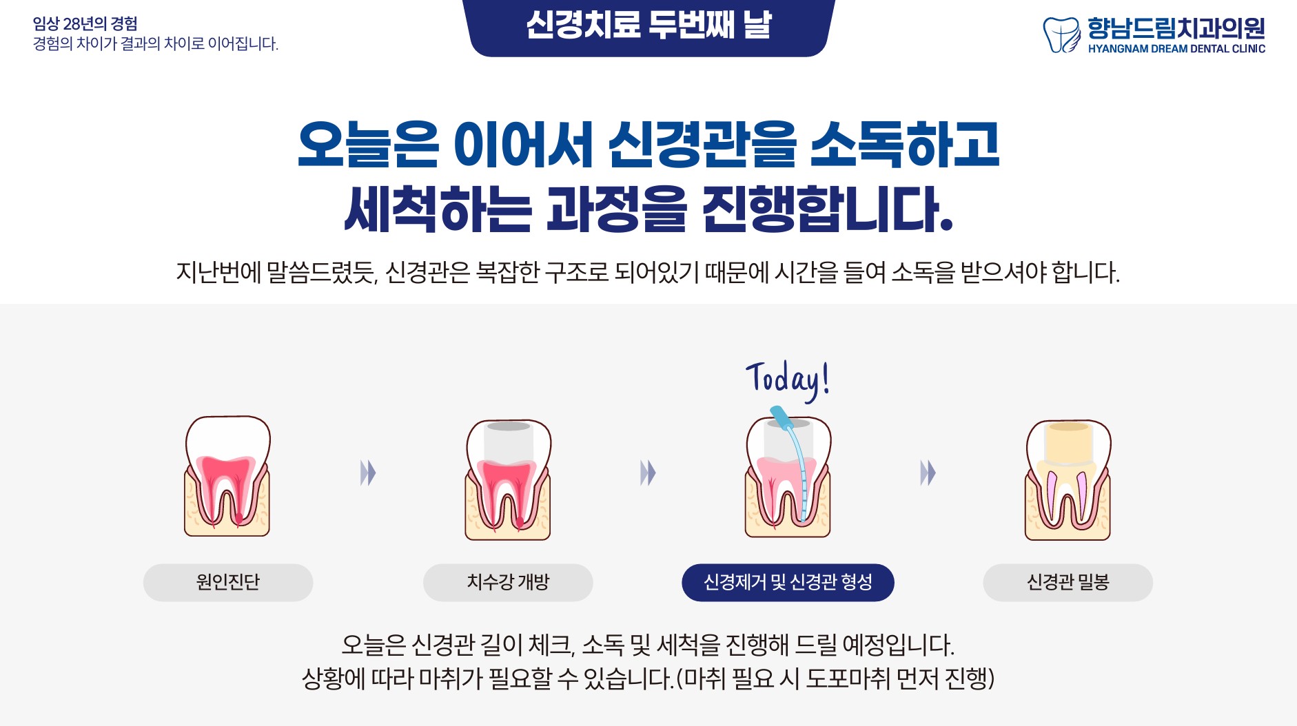 신경치료중간날 과정 1