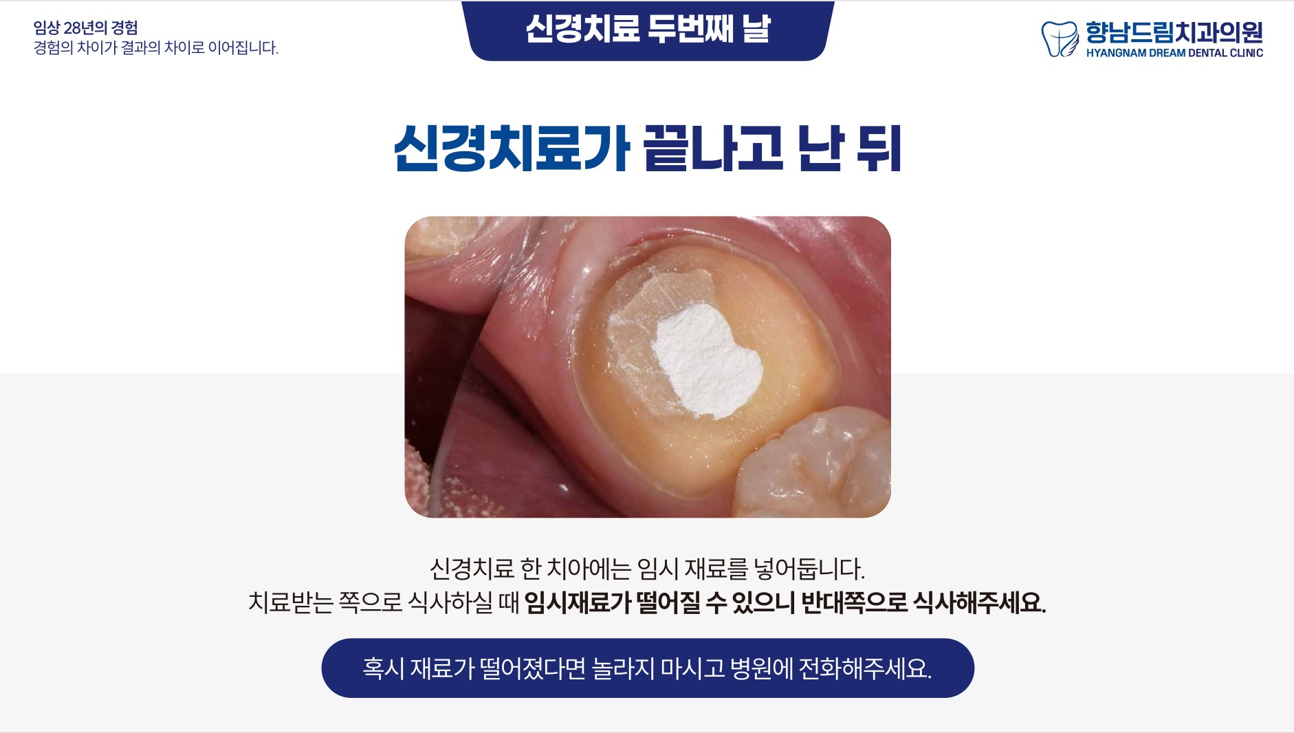 신경치료중간날 과정 4