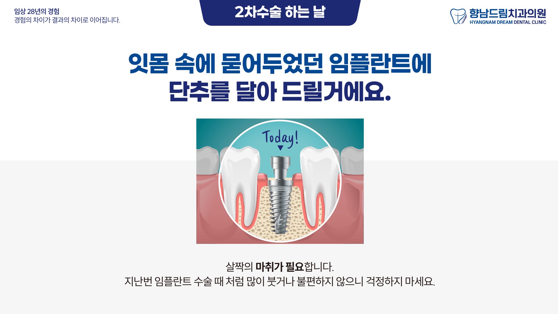 임플란트 2차수술 과정 1