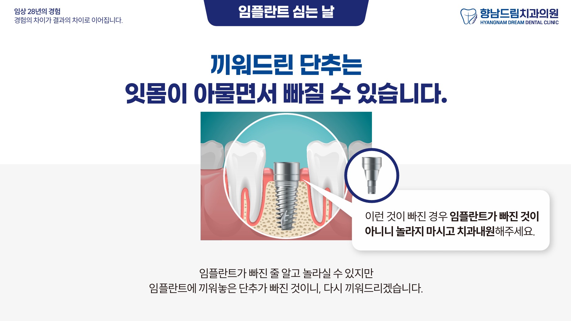 임플란트 2차수술 과정 2