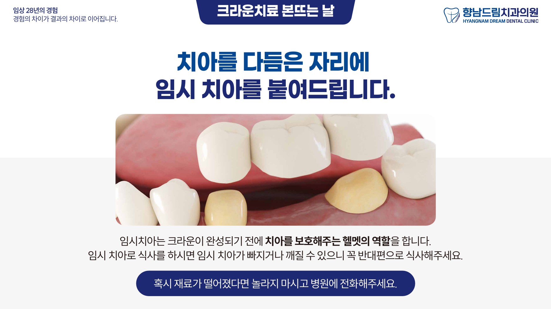 크라운 본뜨는 날 과정 5