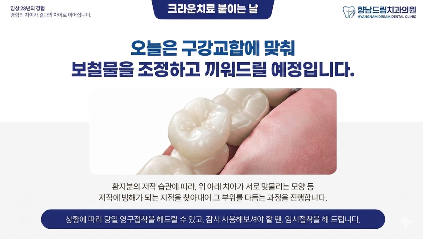 크라운 붙이는 날 과정 1