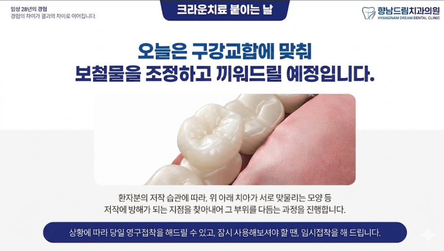 크라운 붙이는 날 과정 2