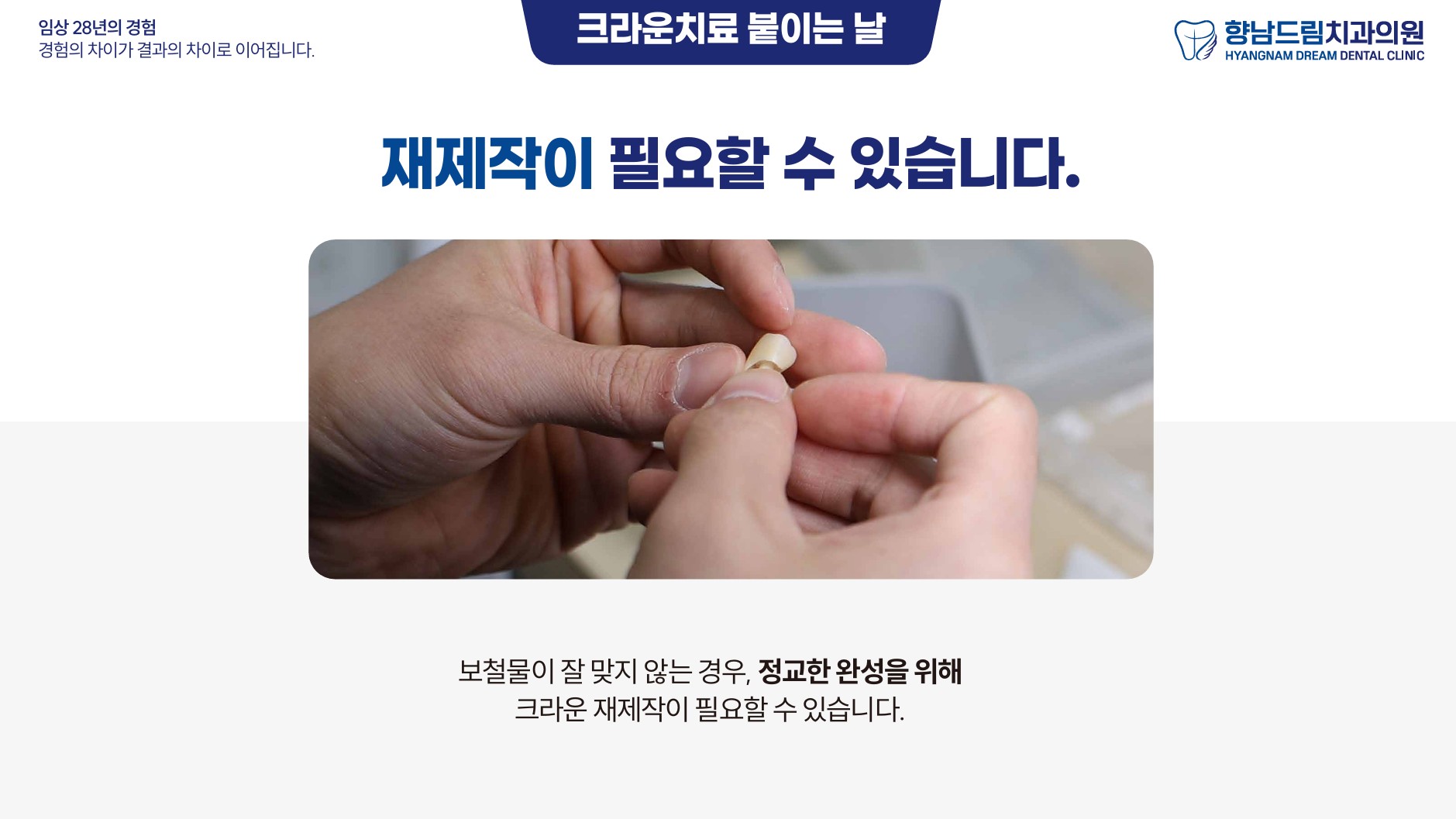 크라운 붙이는 날 과정 3