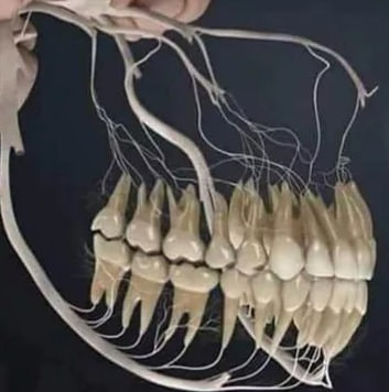 치아와 뇌신경 관계 1